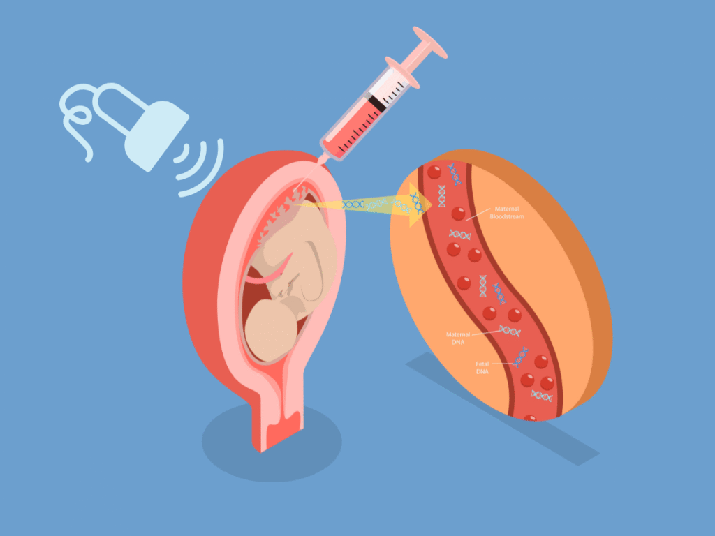 Chorionic Villus Sampling (CVS)